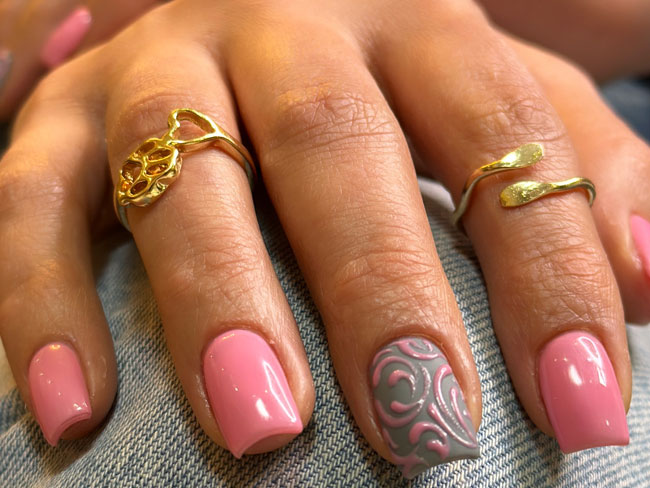 ریموو (حذف کاشت یا ژل قبلی) در مارلیک